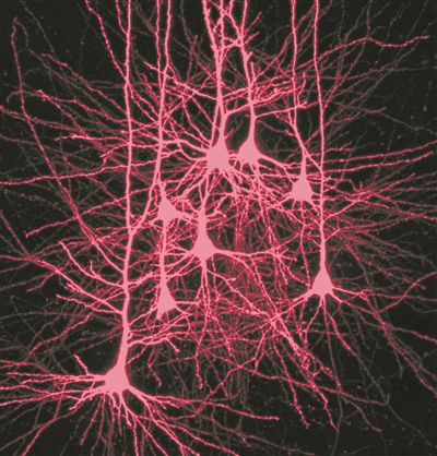 大腦皮層中的神經(jīng)元：慢波睡眠加強了它們之間的聯(lián)系，支持記憶的形成。圖片來源：德國柏林夏里特醫(yī)學(xué)院